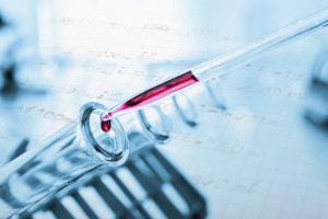 The Case for FDA Regulation of Laboratory-Developed Diagnostic Tests