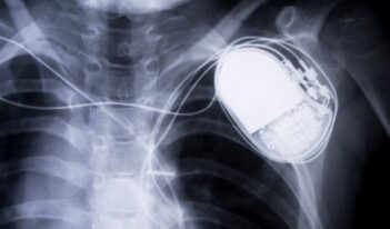 Patching Up Medical Device Cybersecurity Regulation